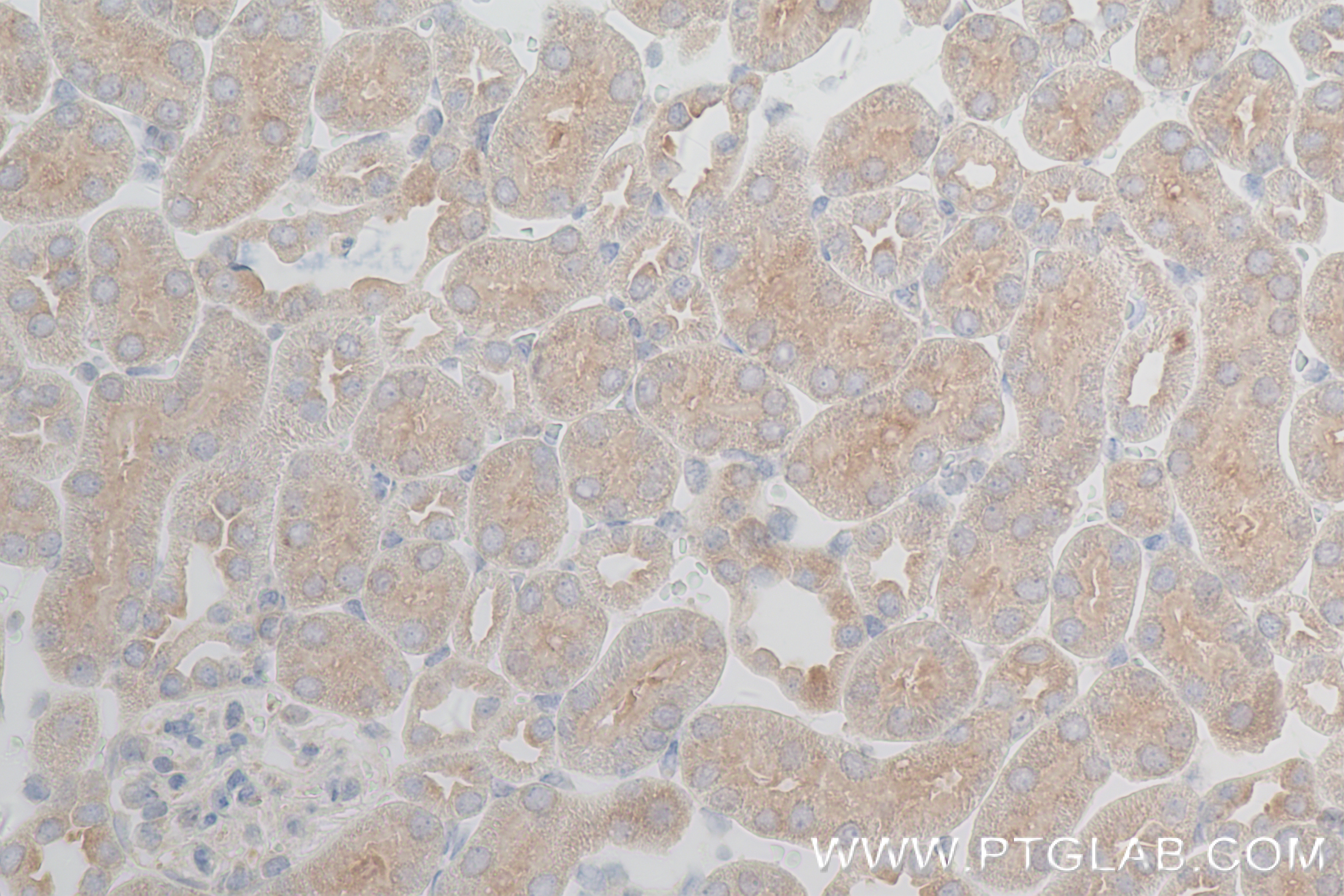 IHC staining of mouse kidney using 84318-4-RR