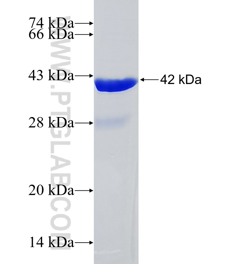 ATPBD3 fusion protein Ag35037 SDS-PAGE