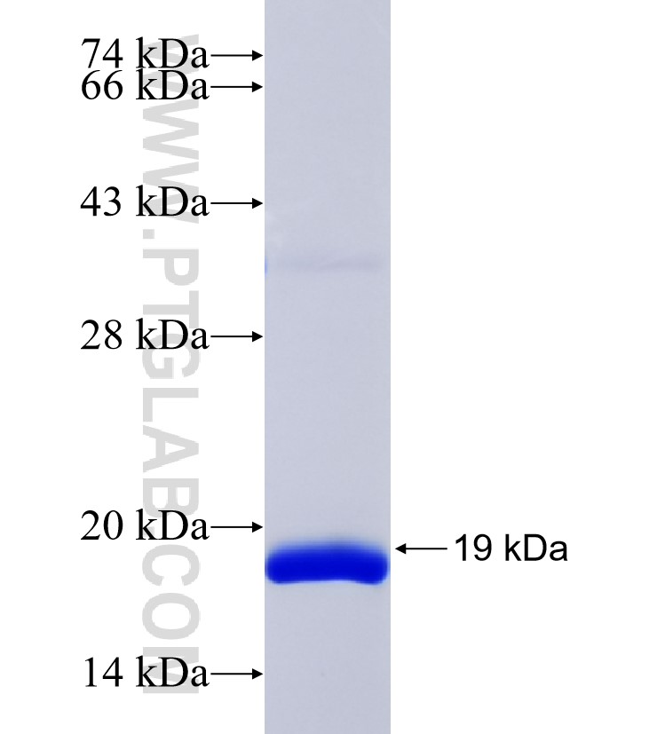 ATPBD3 fusion protein Ag35050 SDS-PAGE