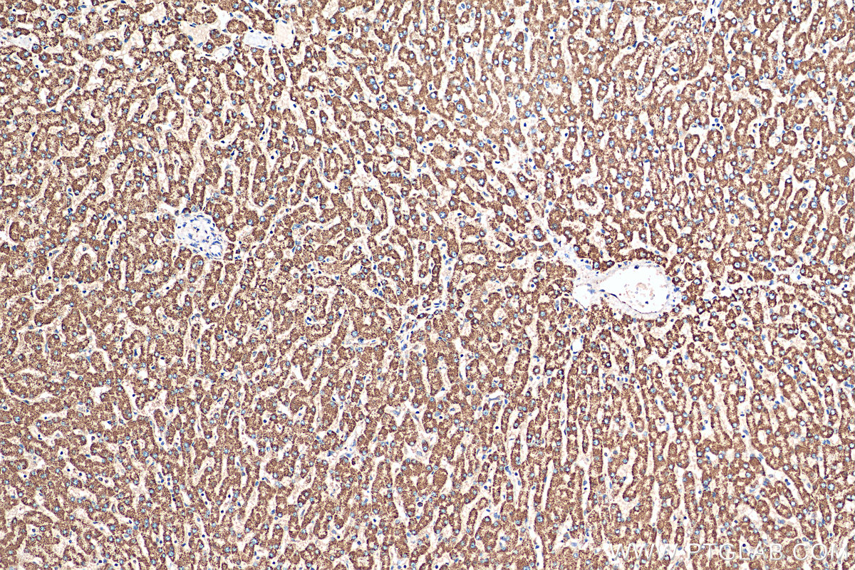 IHC staining of human liver using 12067-1-AP