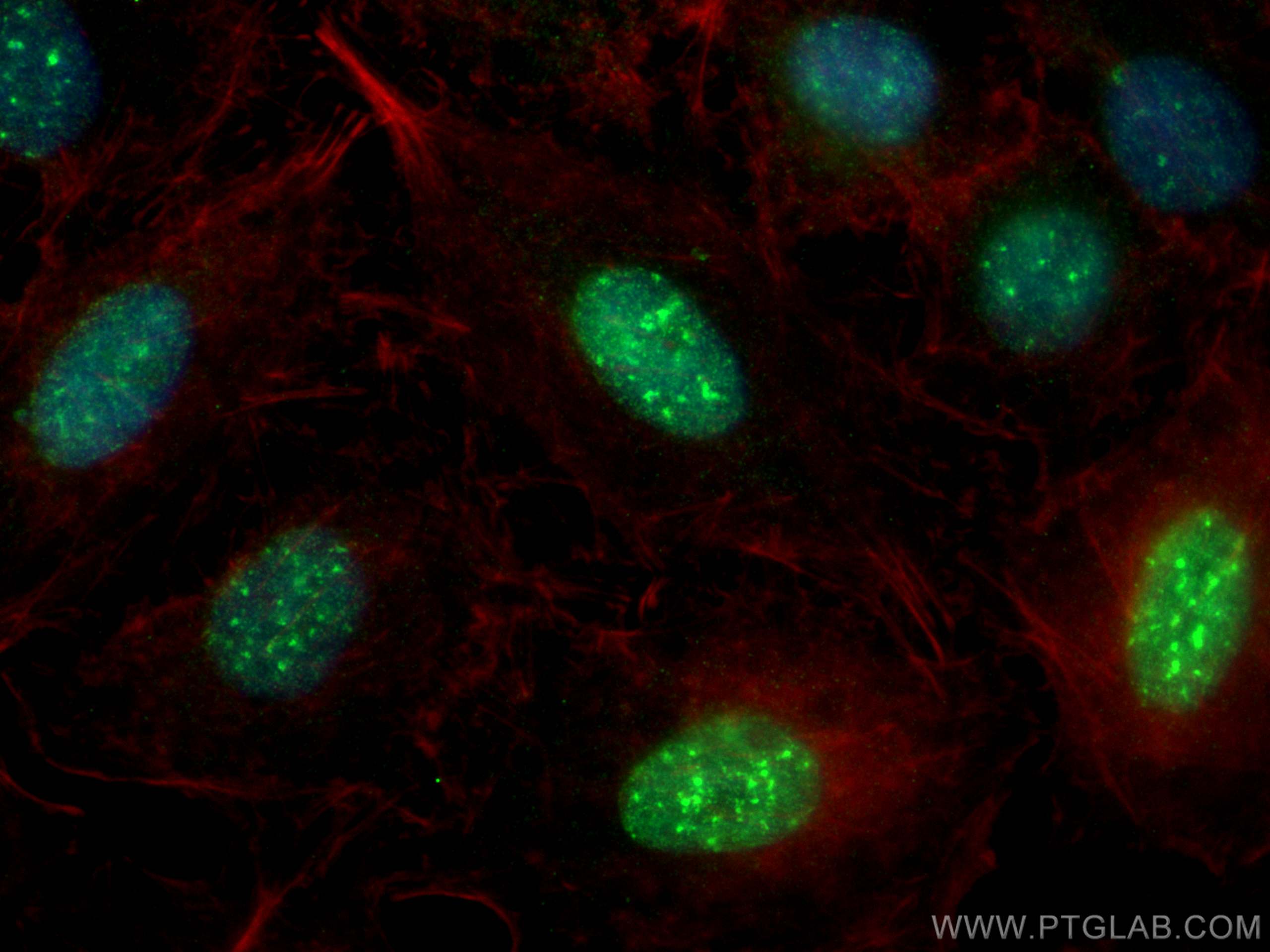 IF Staining of A549 using 20495-1-AP