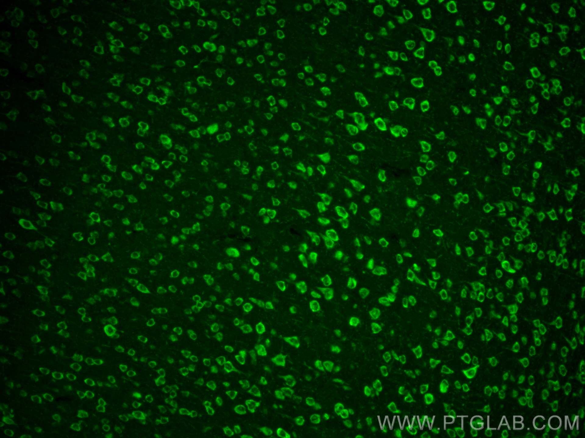 IF Staining of mouse brain using 21776-1-AP