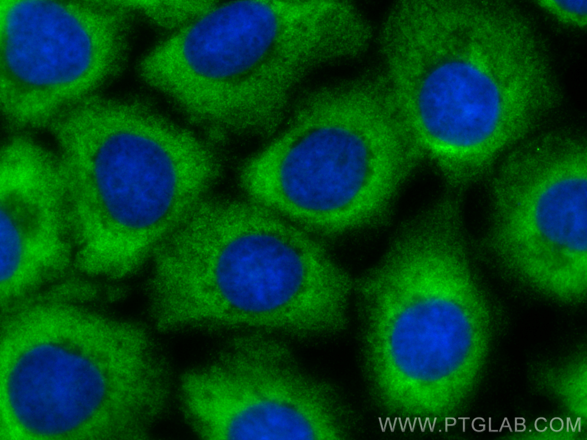 IF Staining of A431 using CL488-24822