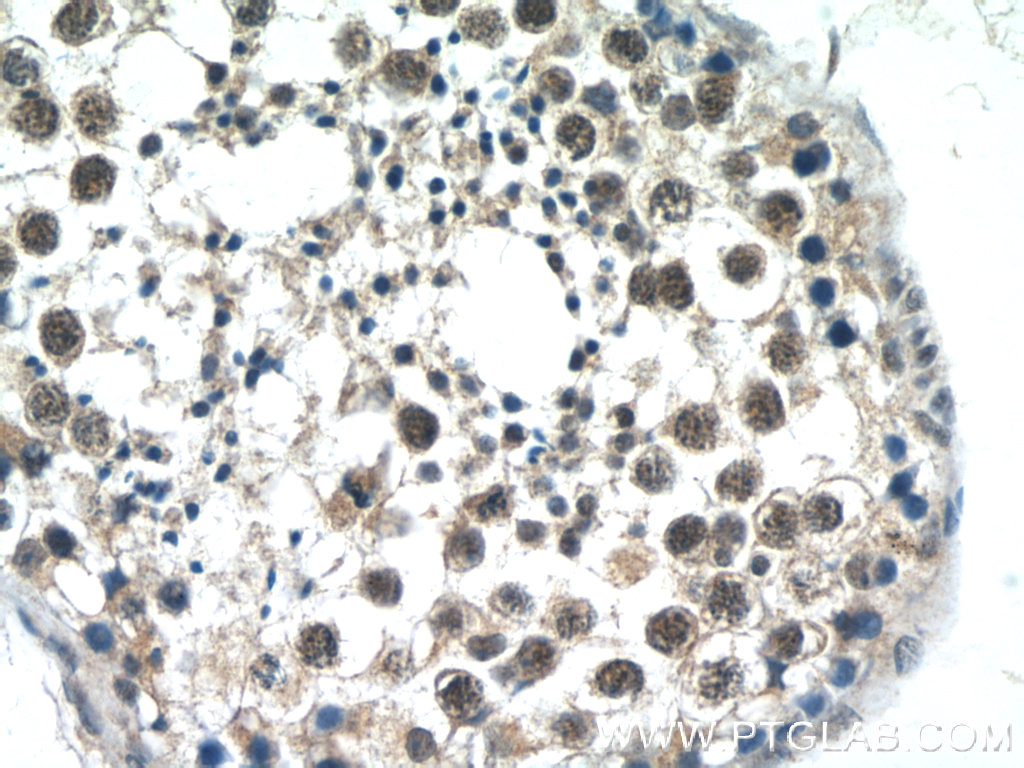 IHC staining of human testis using 23166-1-AP