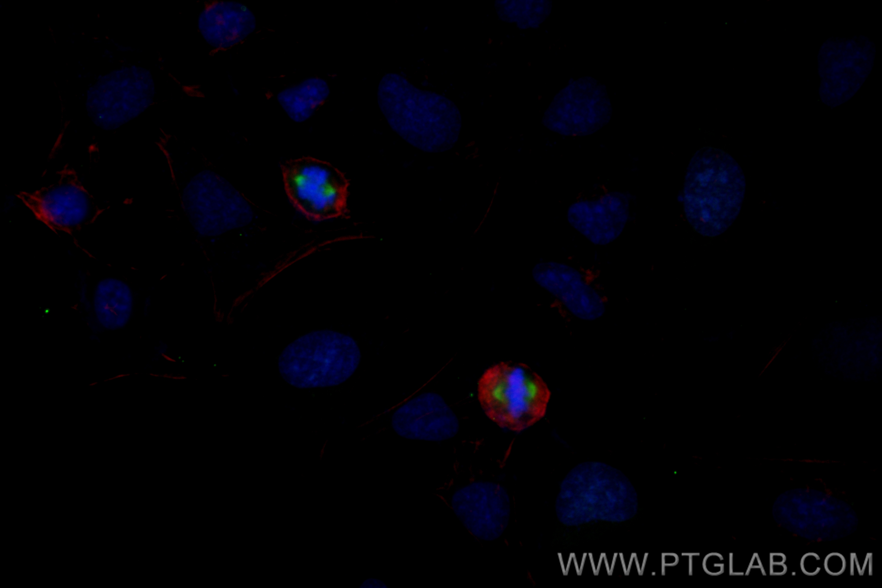 IF Staining of HeLa using CL488-82906