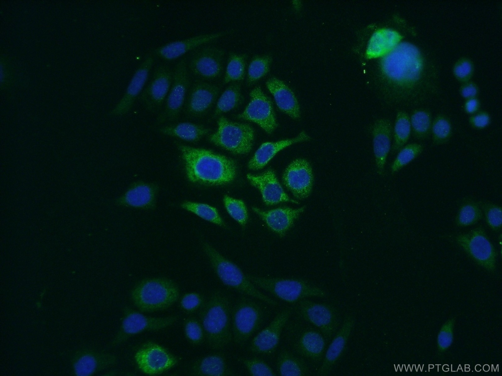 Zinc Alpha 2 Glycoprotein