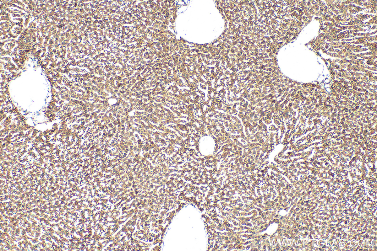 IHC staining of mouse liver using 13399-1-AP