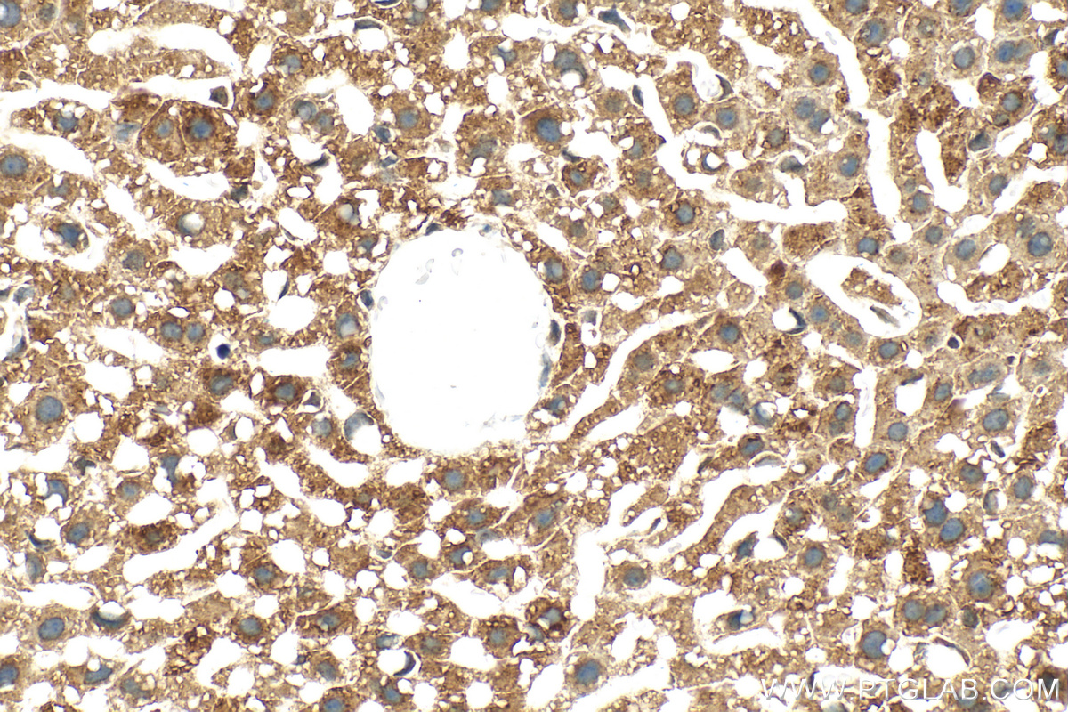 IHC staining of mouse liver using 13399-1-AP