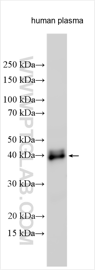 WB analysis using 13399-1-AP