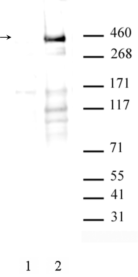 AbFlex ATM phospho Ser1981 antibody (rAb) tested by Western blot. 20 ug HeLa nuclear extract (high salt preparation) untreated (lane 1) or treated with VP16 at 100 uM for 8 hrs (Lane 2), probed with 1 ug/ml ATM phospho Ser1981 antibody. For optimal results, primary antibody incubations should be performed at room temperature. The addition of 0.1% Tween 20 to all Blotto solutions may also reduce background. Individual optimization may be required.