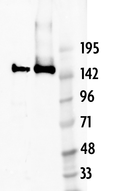 AbFlex Cas9 antibody (rAb) tested by Western blot. 50 ng recombinant Cas9 protein was probed with 0.5 ug/ml AbFlex Cas9 antibody (Lane 1). HEK293T cells were transfected with a plasmid containing a mammalian expression construct for dCas9 (S. pyogenes). Chromatin was prepared 48 hours post-transfection, boiled and 15 ul (~200,000 cell equivalents) was run on a SDS-PAGE gel and probed with 2 ug/ml AbFlex Cas9 antibody (Lane 2). A molecular weight marker was run in Lane 3.