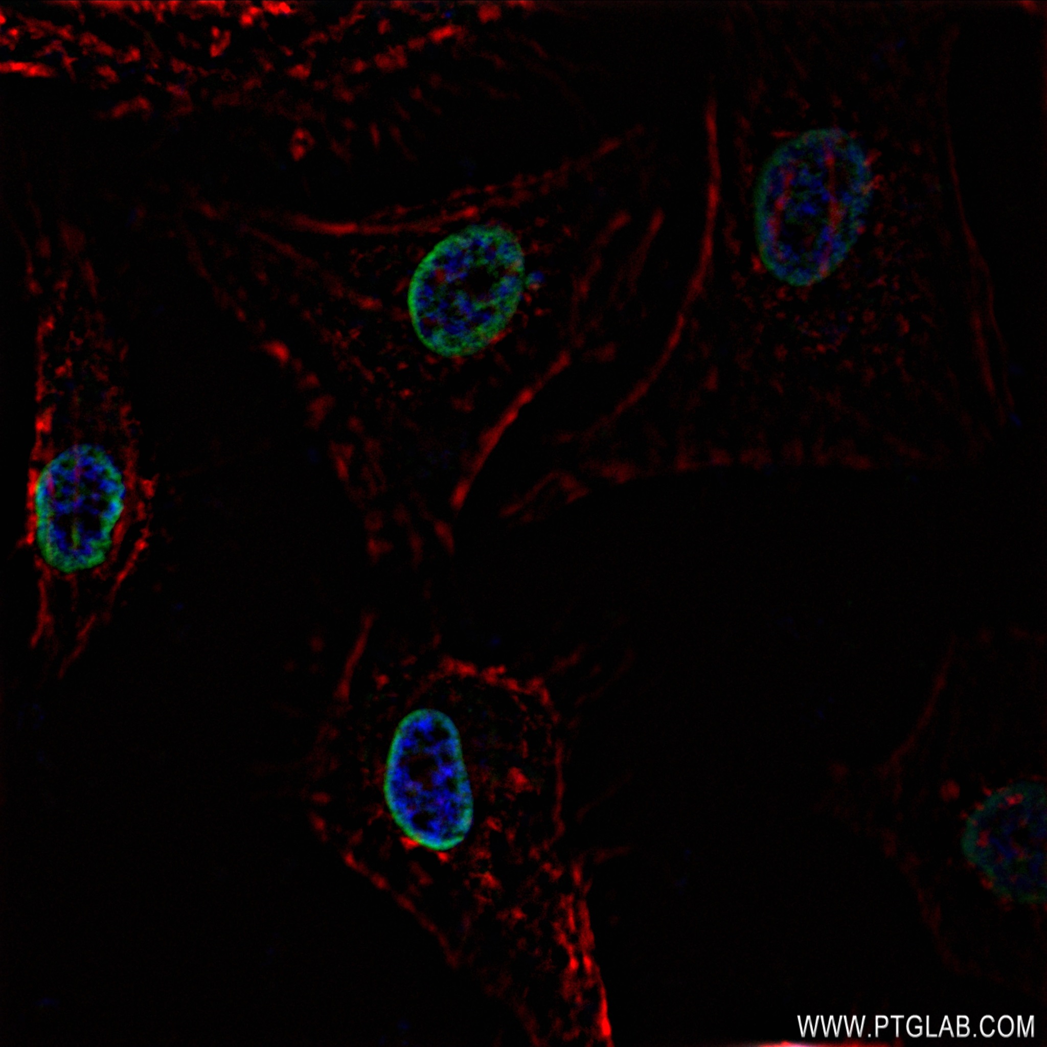 IF Staining of HeLa using 83041-1-RR (same clone as 83041-1-PBS)
