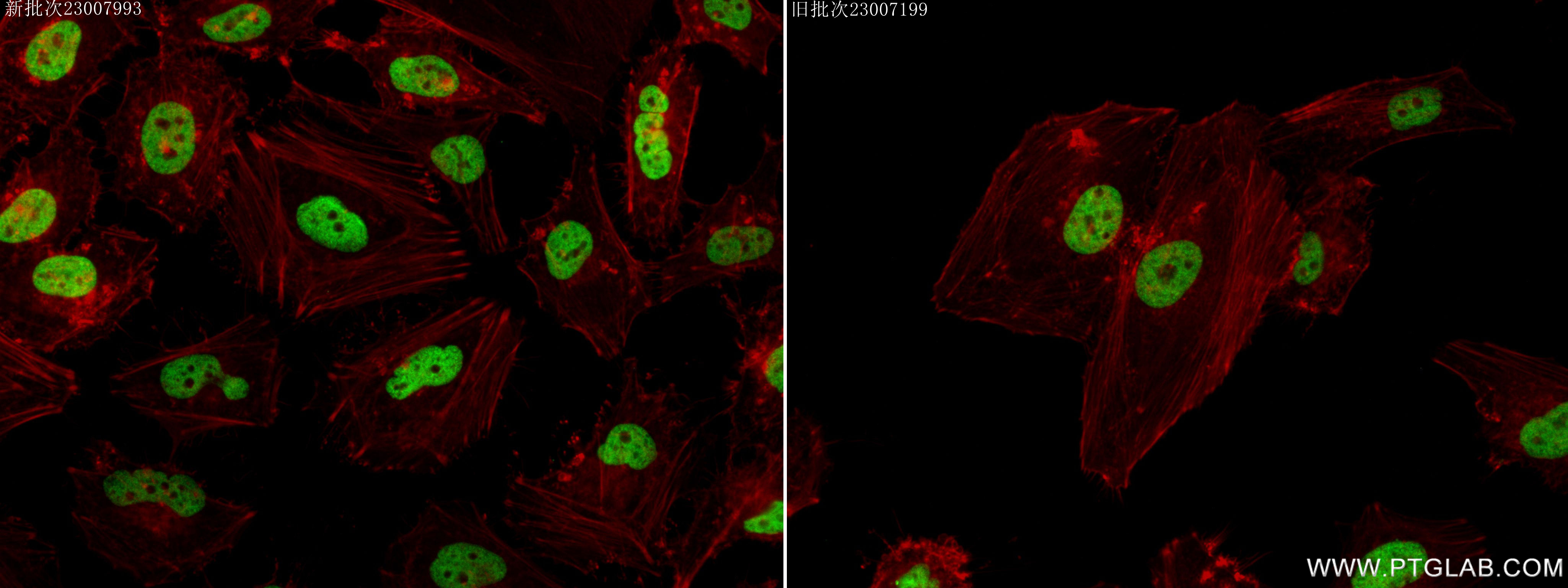 IF Staining of HeLa using 83041-1-RR (same clone as 83041-1-PBS)