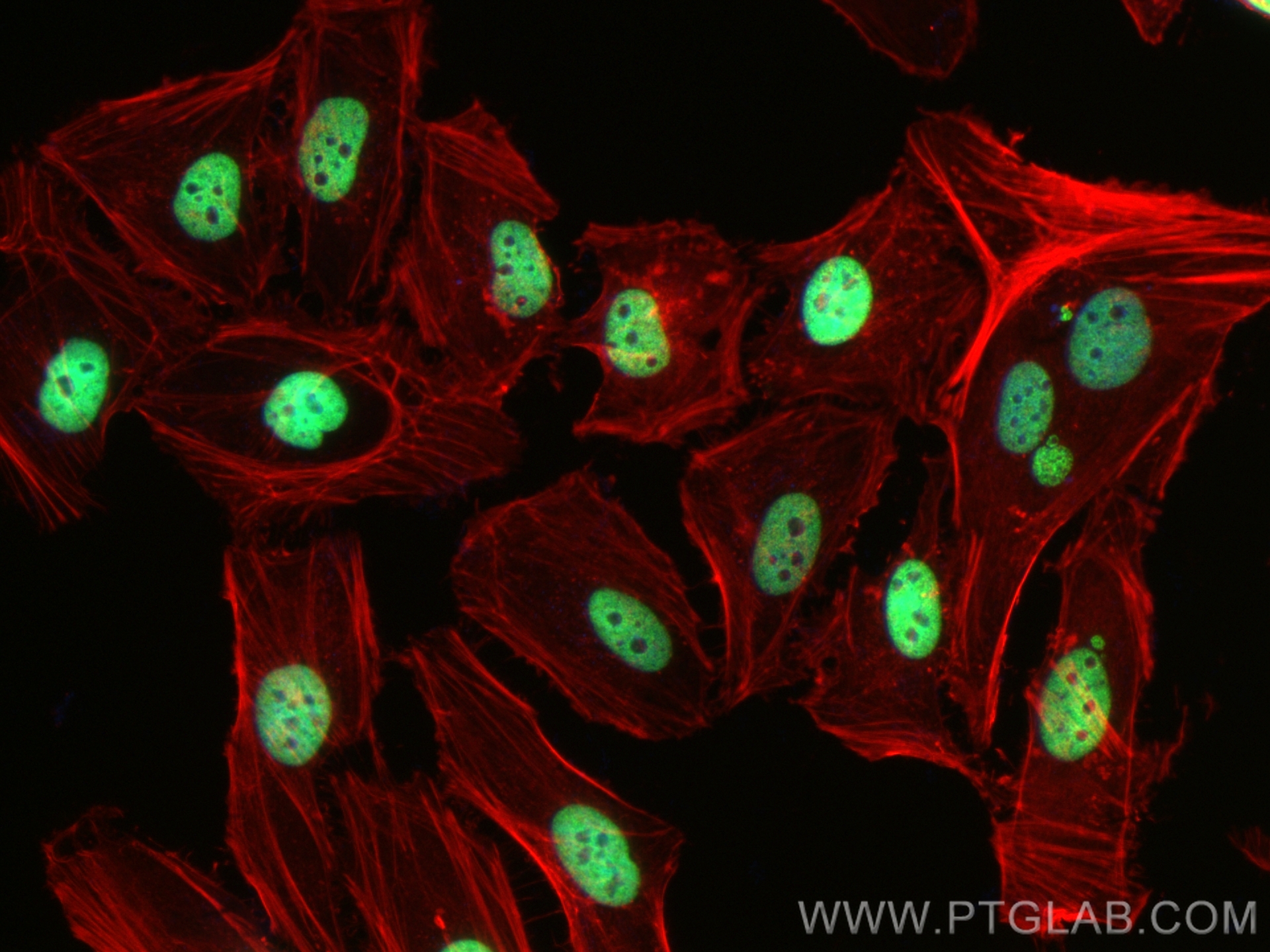 IF Staining of HeLa using 83041-1-RR (same clone as 83041-1-PBS)