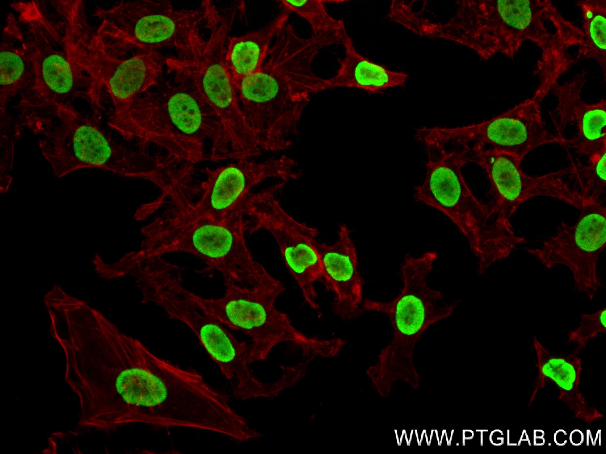 IF Staining of HeLa using 83041-1-RR (same clone as 83041-1-PBS)