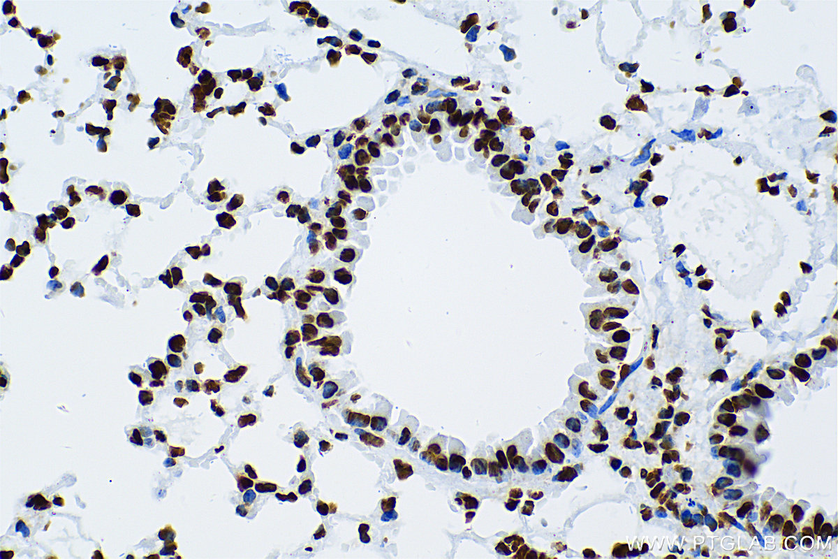 IHC staining of mouse lung using 83041-1-RR