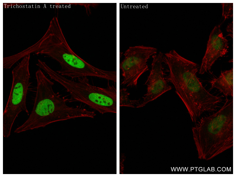 IF Staining of HeLa using 84551-1-RR (same clone as 84551-1-PBS)