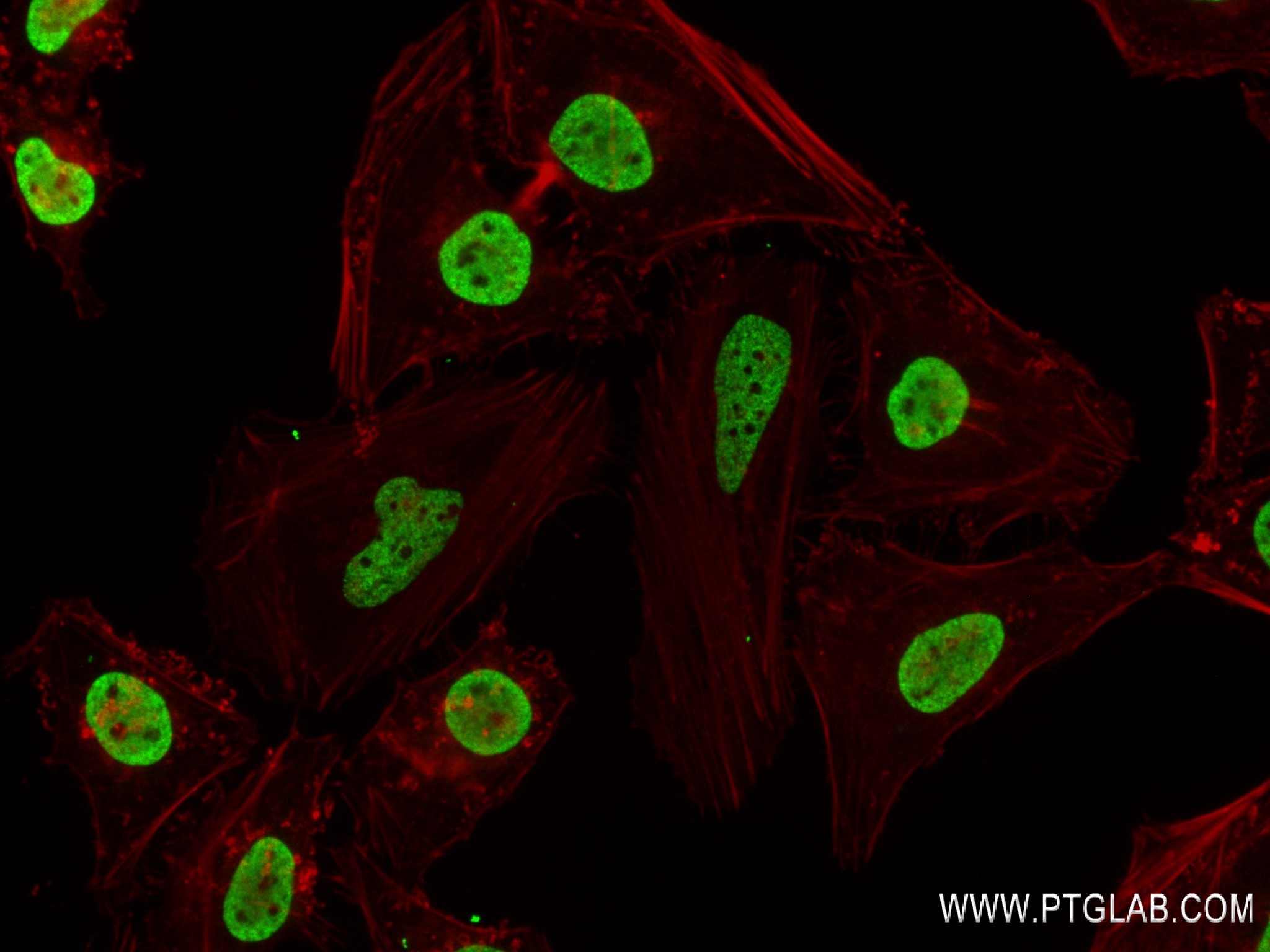 Acetyl-Histone H2B (Lys16)