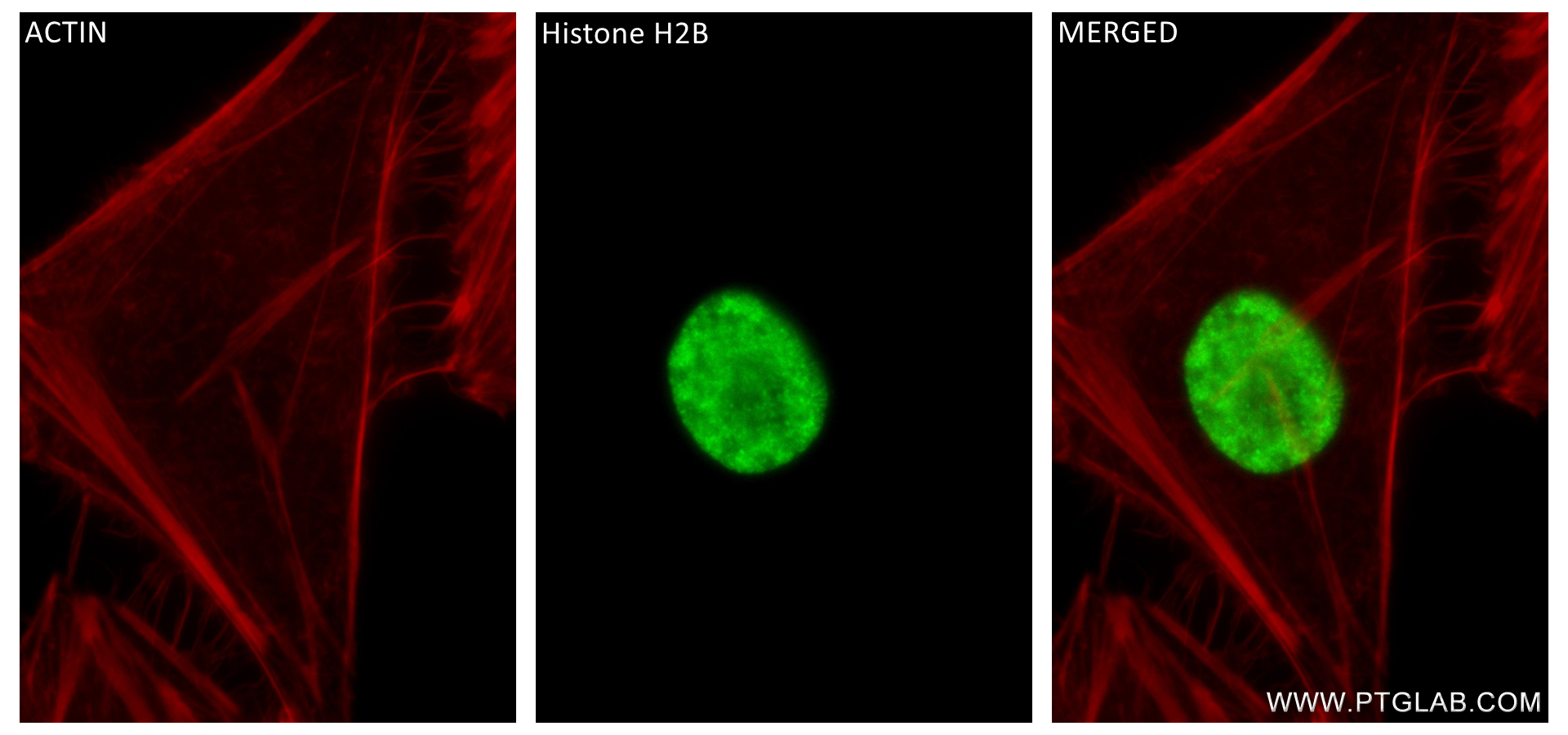 IF Staining of HeLa using 84549-1-RR