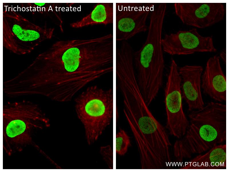 IF Staining of HeLa using 83171-4-RR