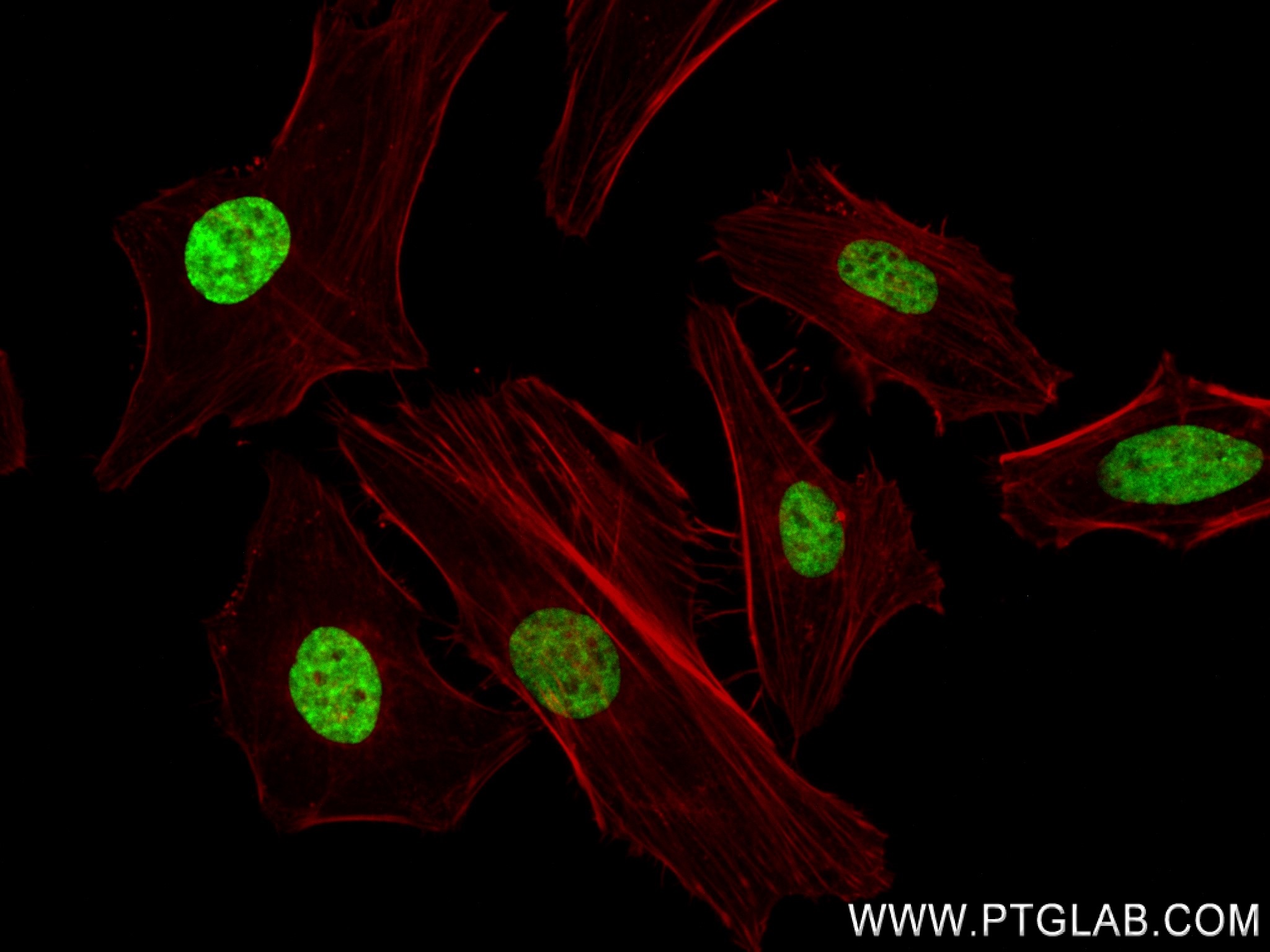 IF Staining of HeLa using 82838-2-RR (same clone as 82838-2-PBS)