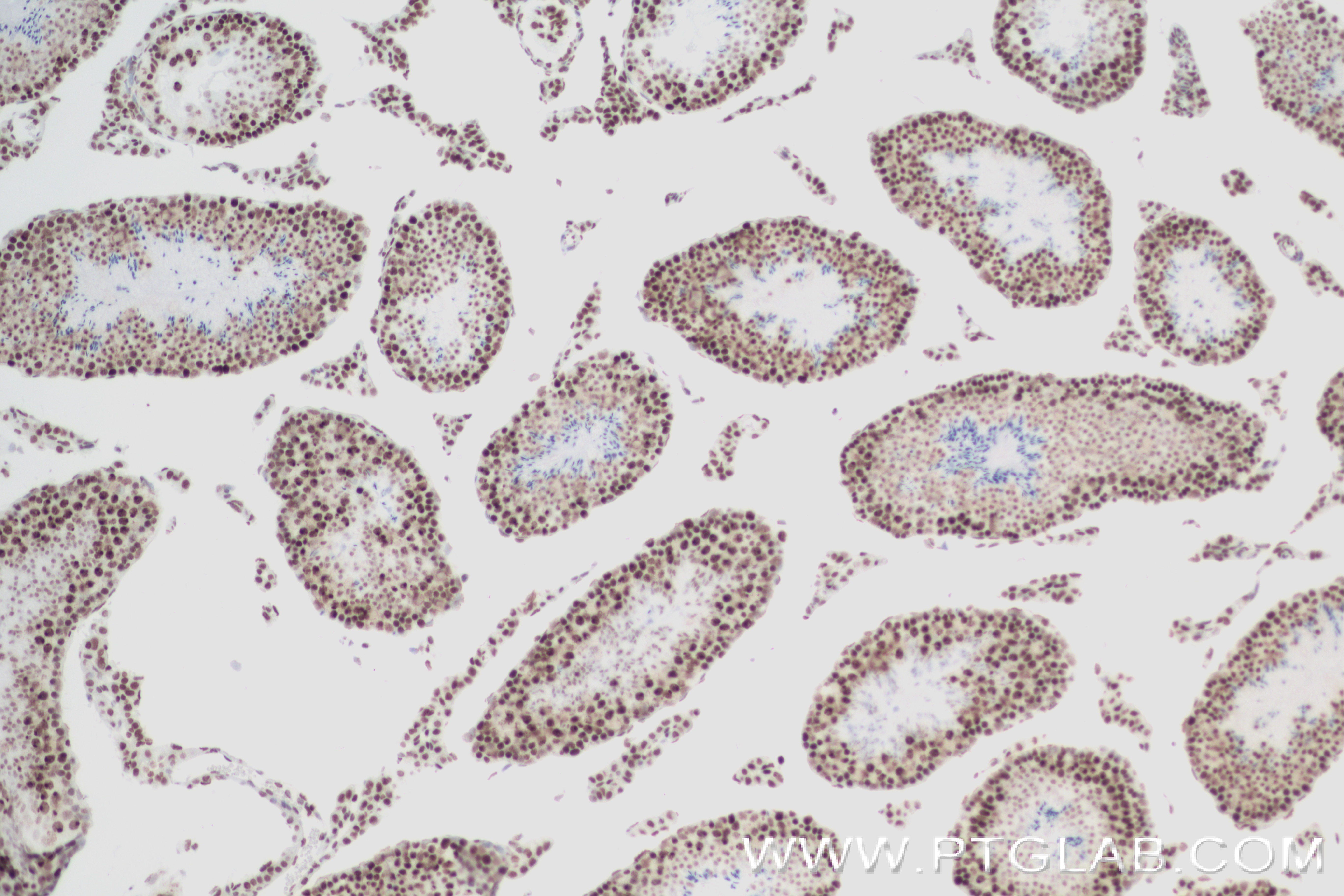 IHC staining of mouse testis using 82838-2-RR (same clone as 82838-2-PBS)