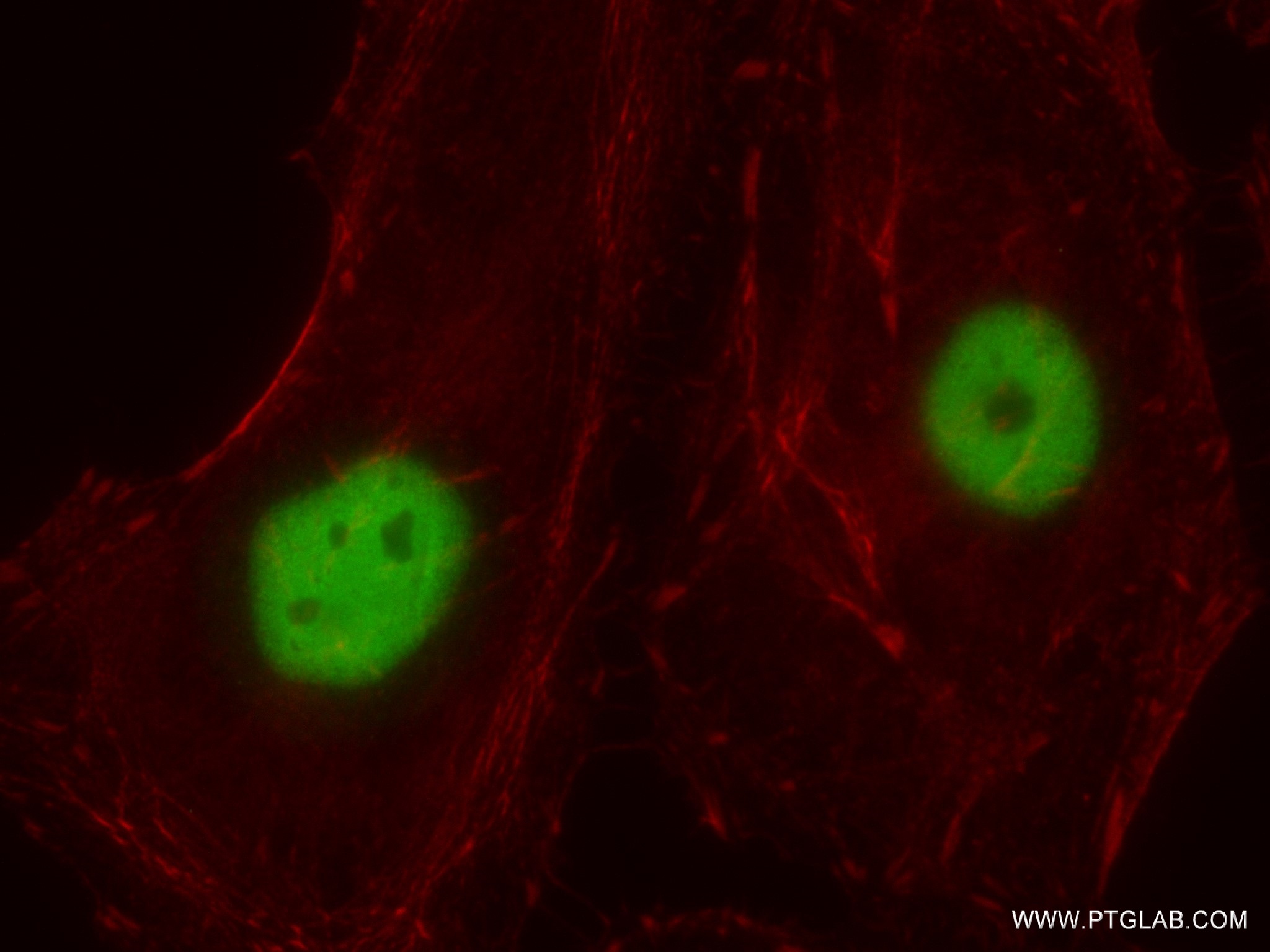 IF Staining of HeLa using 82902-1-RR