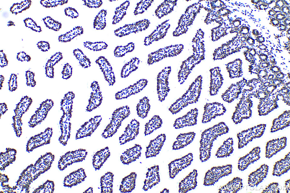 IHC staining of mouse small intestine using 83095-1-RR