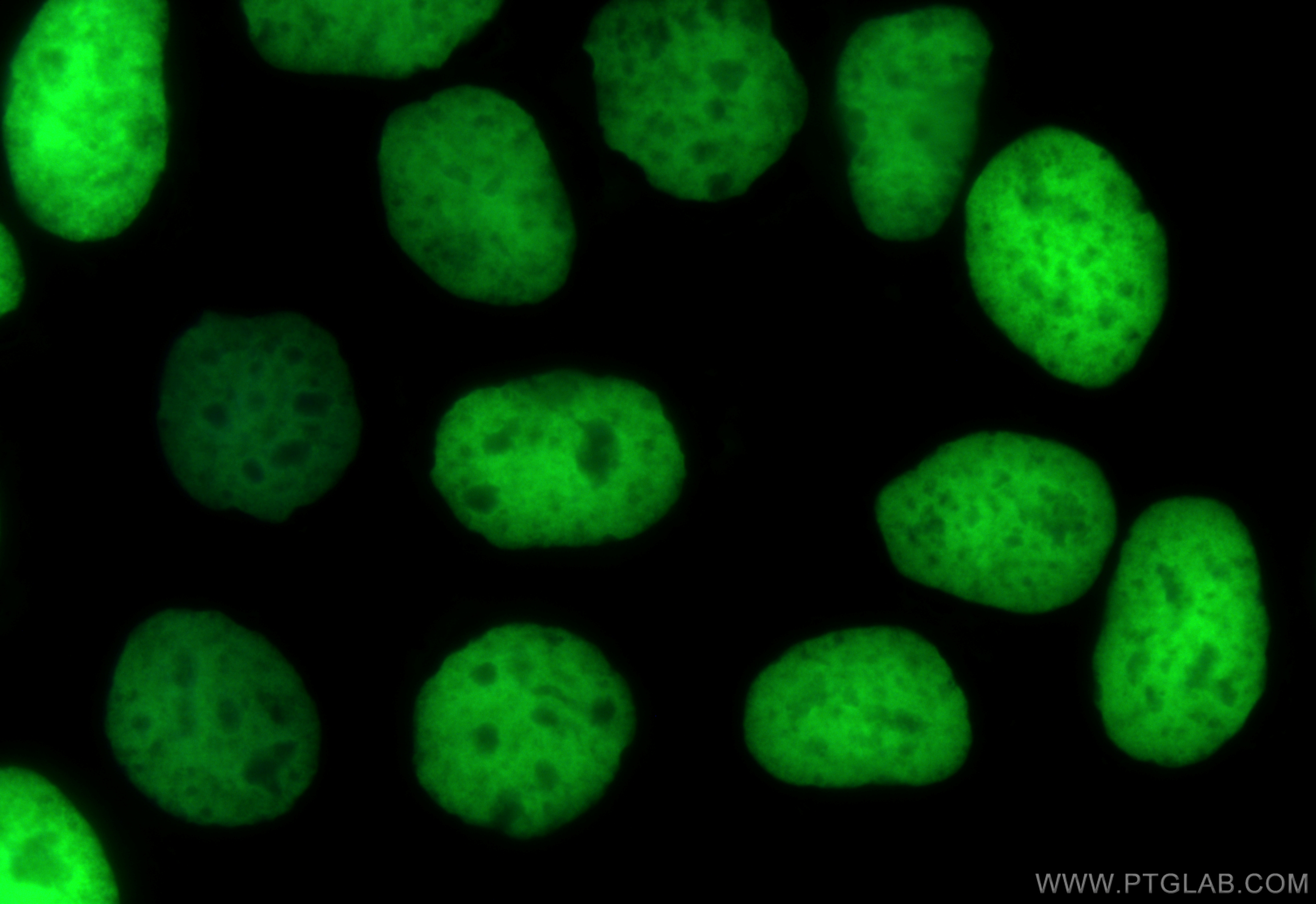 IF Staining of Caco-2 using CL488-83095