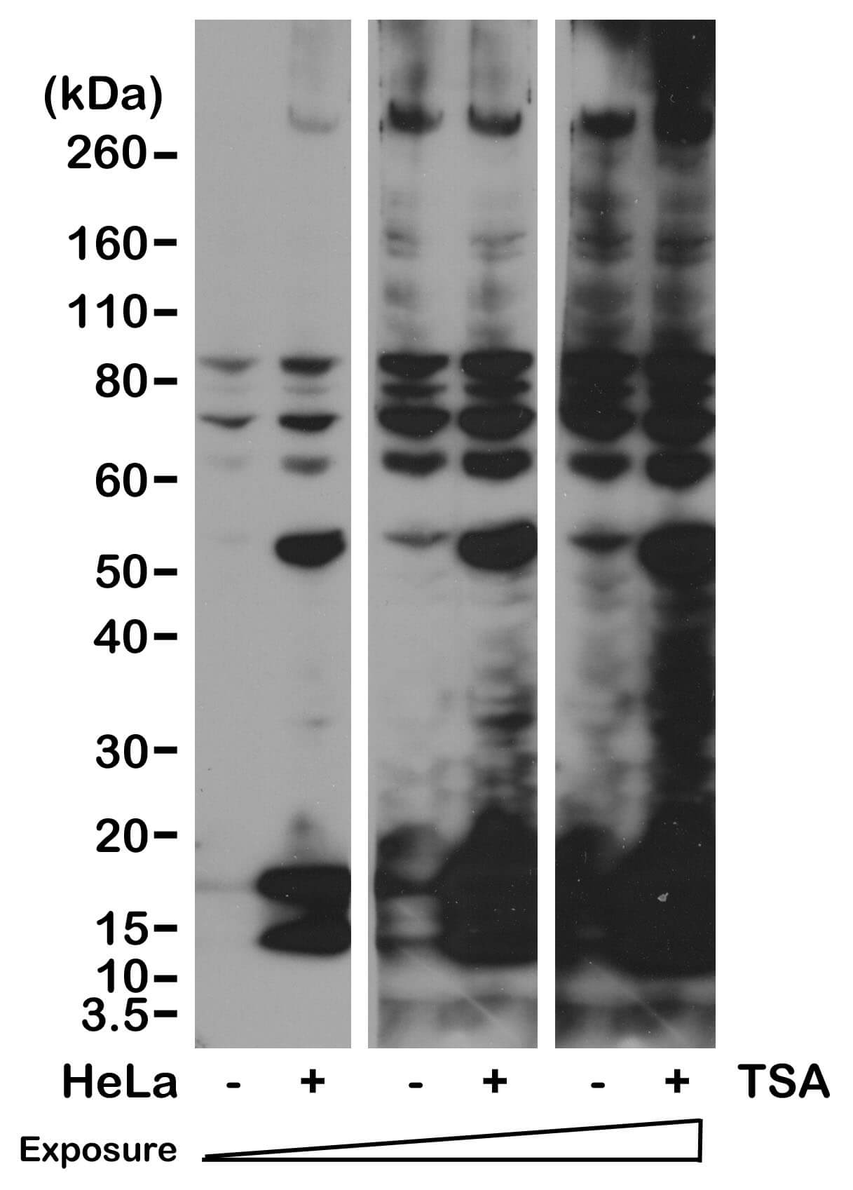 Western blot of Acetyl-Lysine antibody (rAb). HeLa cells nontreated or treated with Trichostatin A (TSA), were probed using Acetyl-Lysine antibody (RM101) at 0.5 ug/ml.