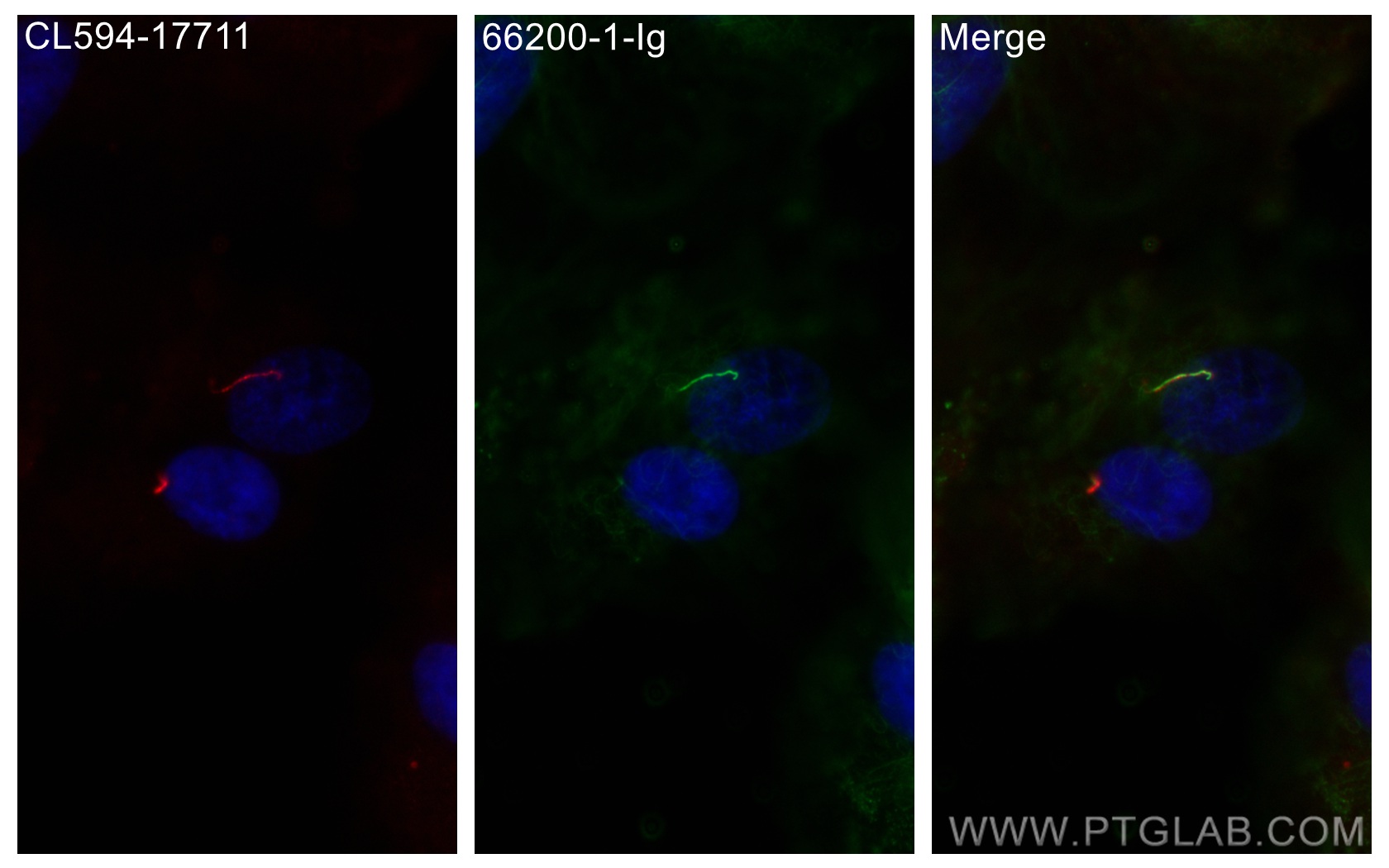 IF Staining of hTERT-RPE1 using 66200-1-Ig