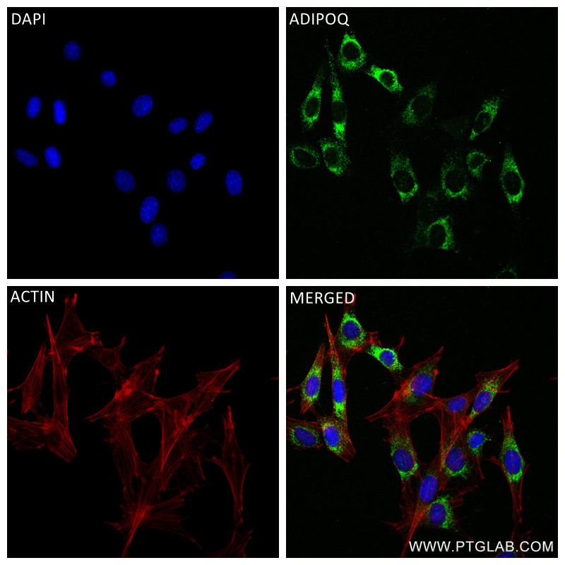 IF Staining of 3T3-L1 using 83961-1-RR (same clone as 83961-1-PBS)