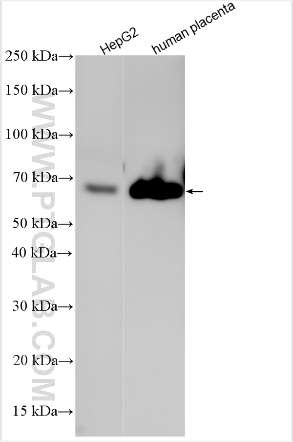 WB analysis using 31256-1-AP