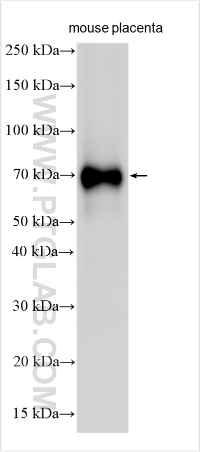 WB analysis using 31256-1-AP