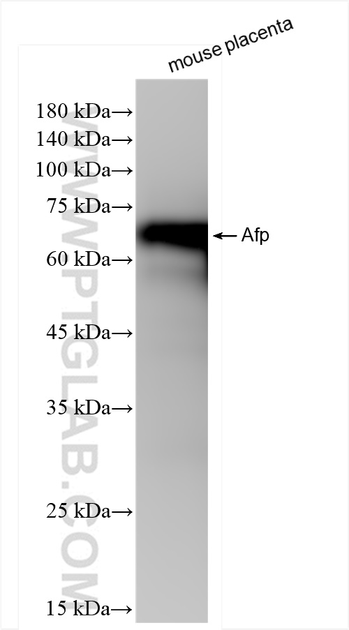 WB analysis of mouse placenta using 83367-2-RR (same clone as 83367-2-PBS)