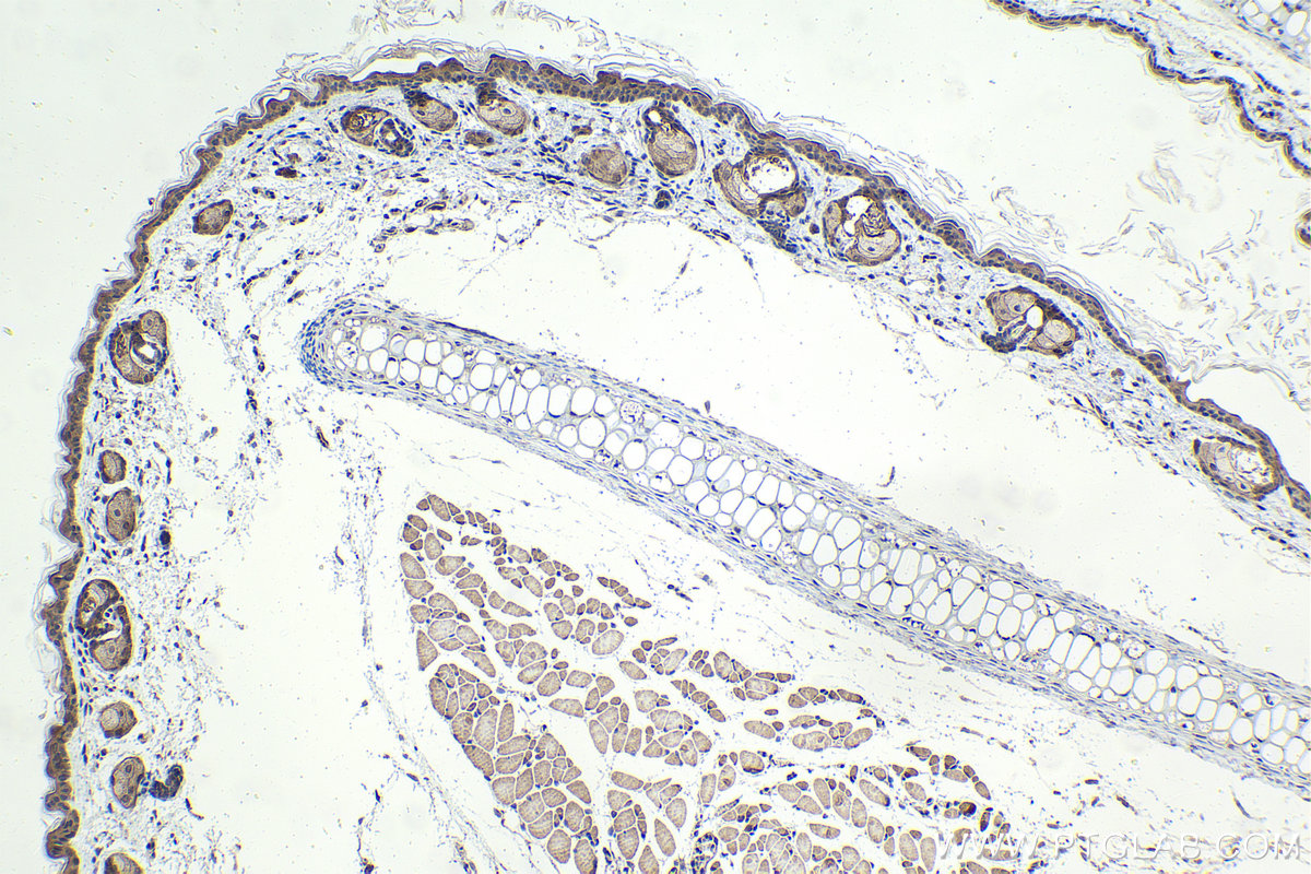 IHC staining of mouse skin using 28686-1-AP