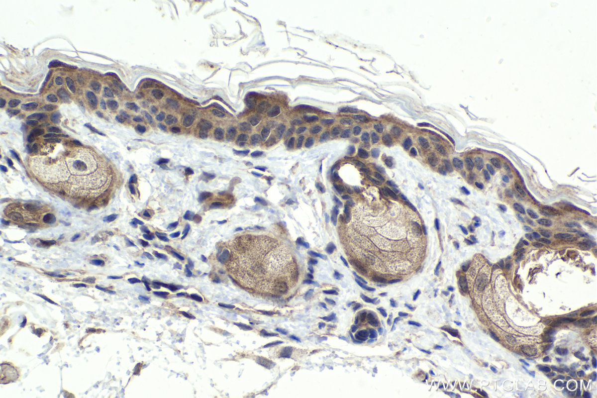 IHC staining of mouse skin using 28686-1-AP