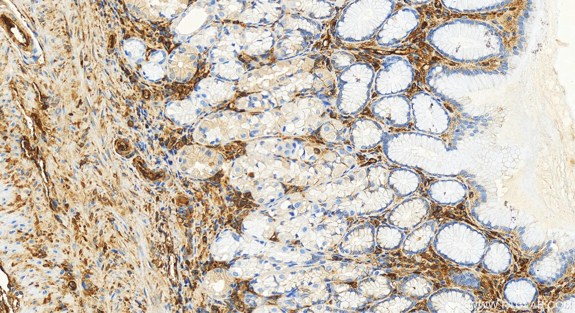 IHC staining of human stomach using 82783-6-RR