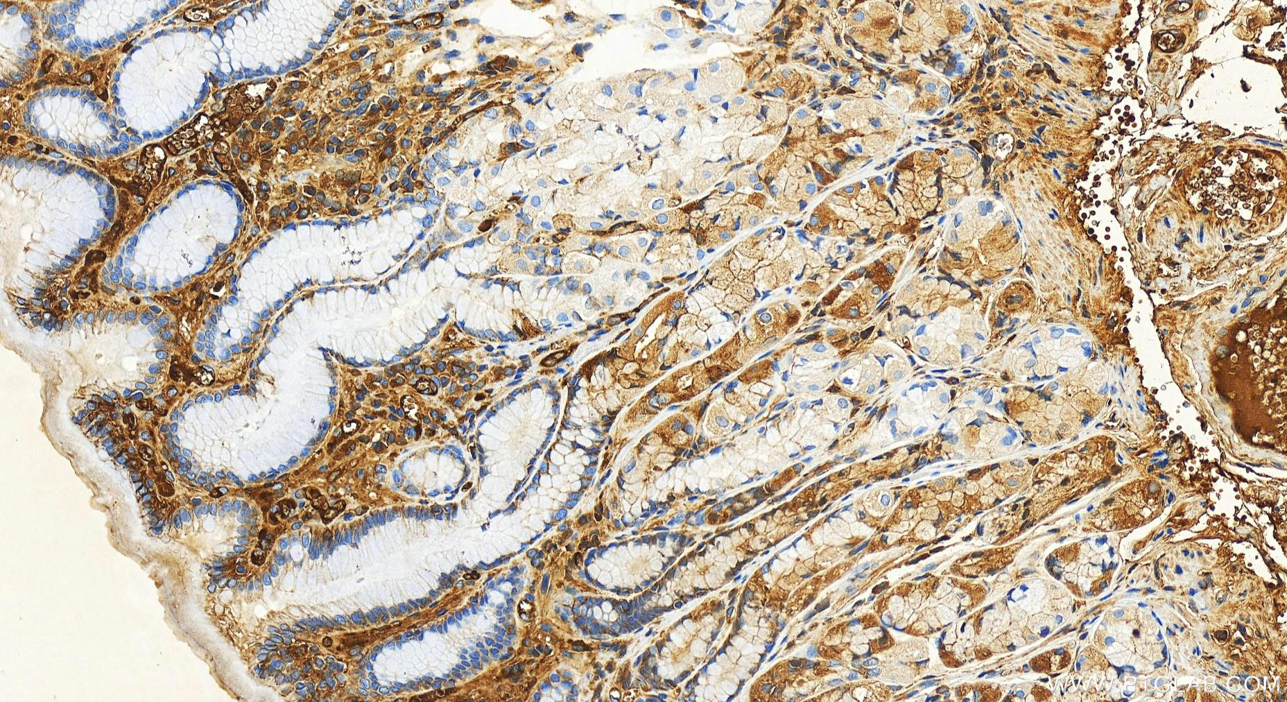 IHC staining of human stomach using 82783-6-RR