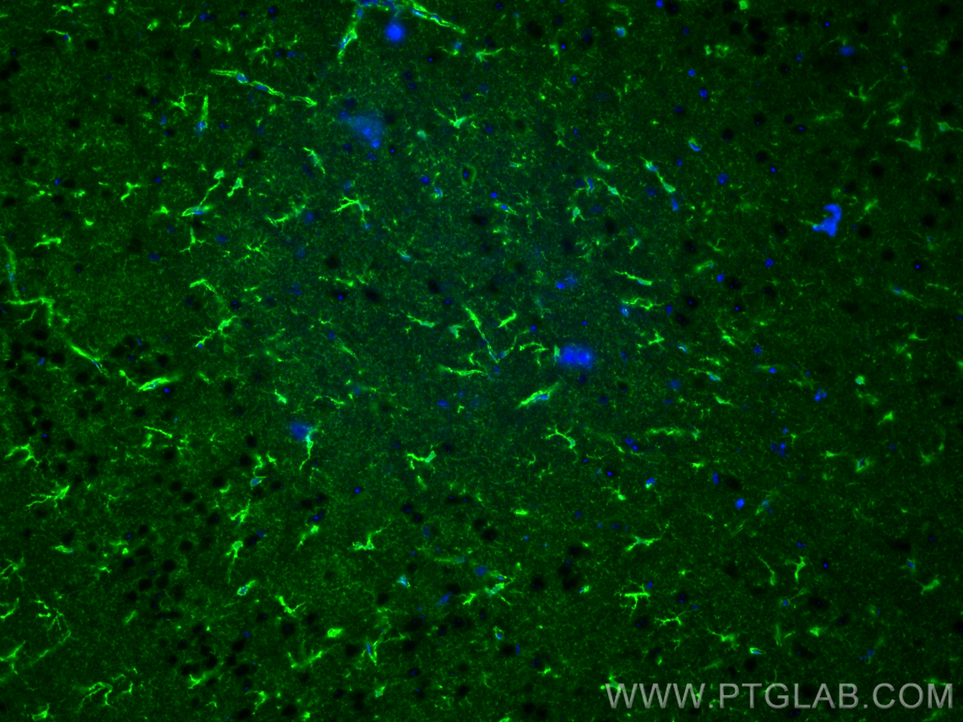 IF Staining of mouse brain using CL488-14884