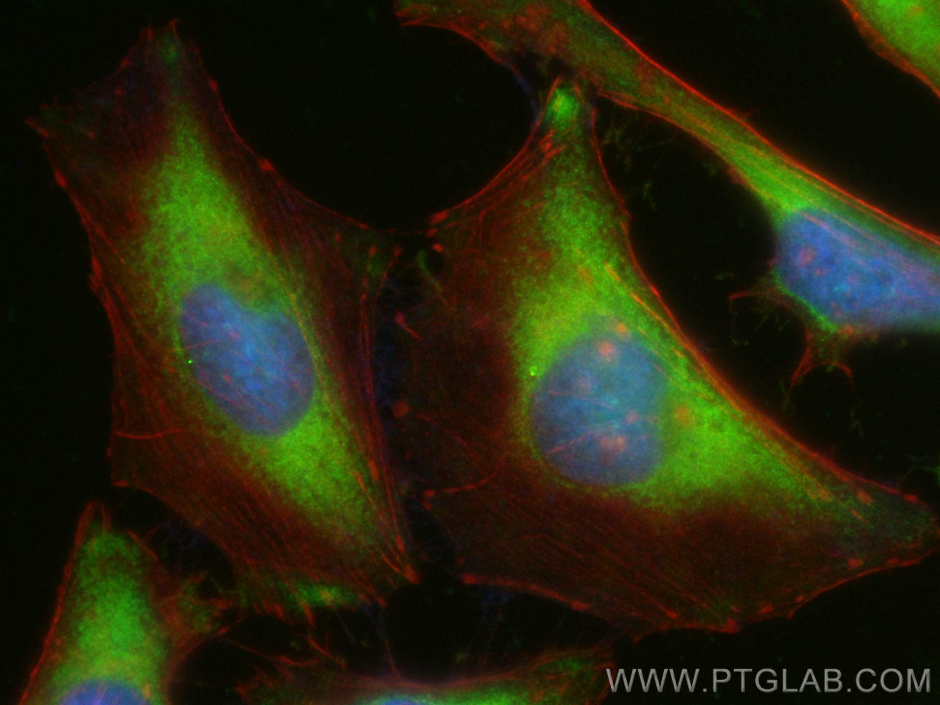 IF Staining of HeLa using CL488-12422