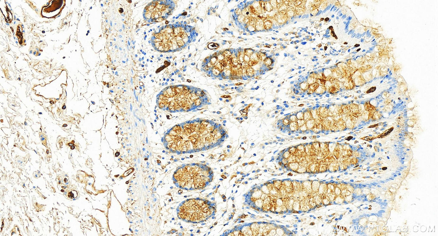 IHC staining of human colon using 82918-1-RR