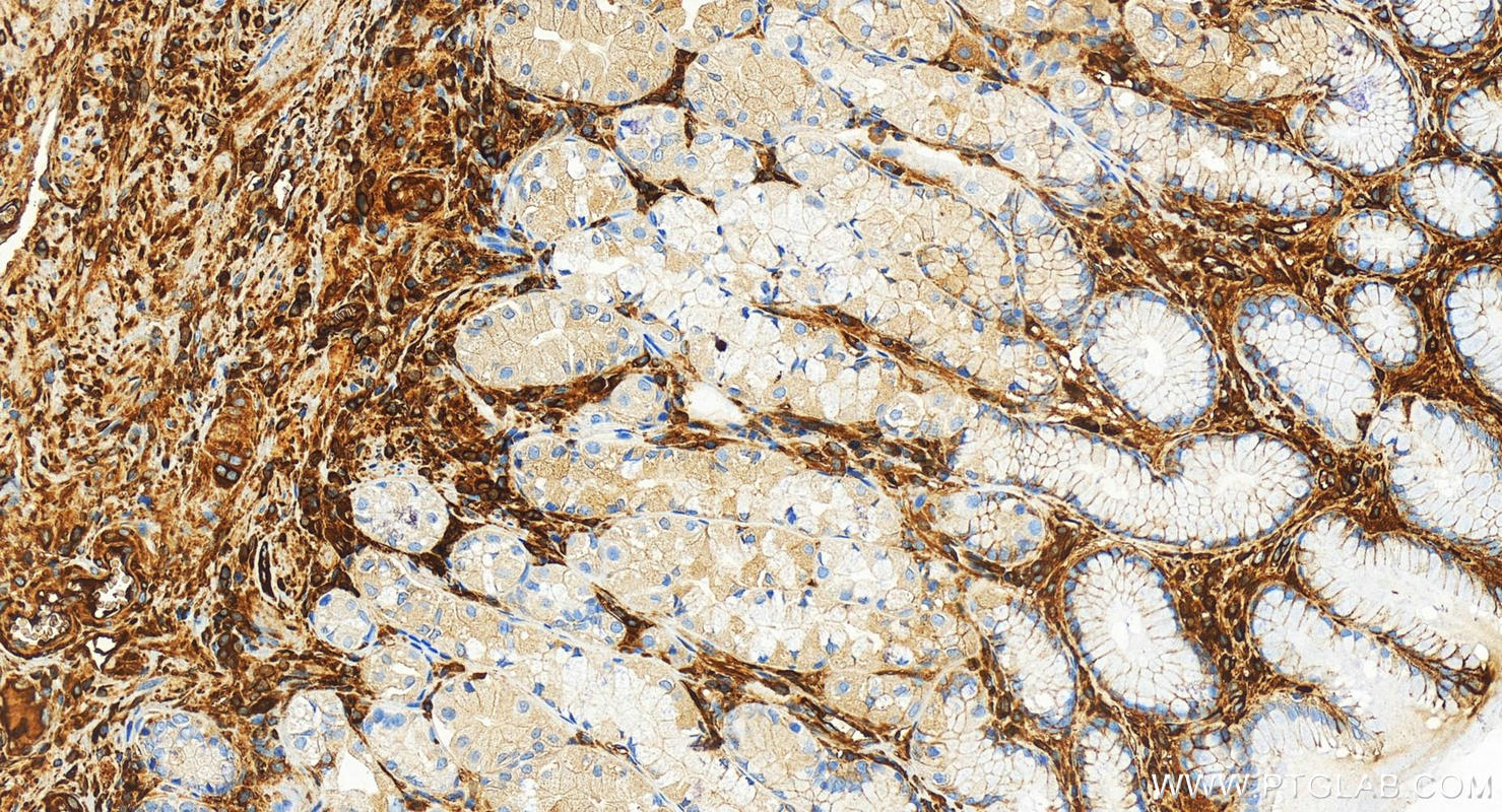 IHC staining of human stomach using 82918-1-RR (same clone as 82918-1-PBS)