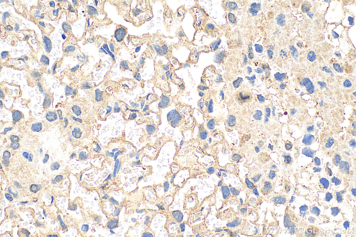 IHC staining of mouse placenta using 25876-1-AP