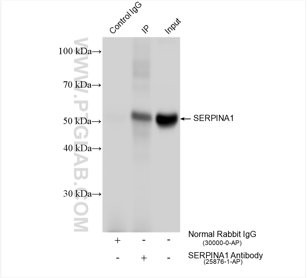 Alpha-1-antitrypsin