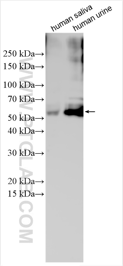 WB analysis using 25876-1-AP