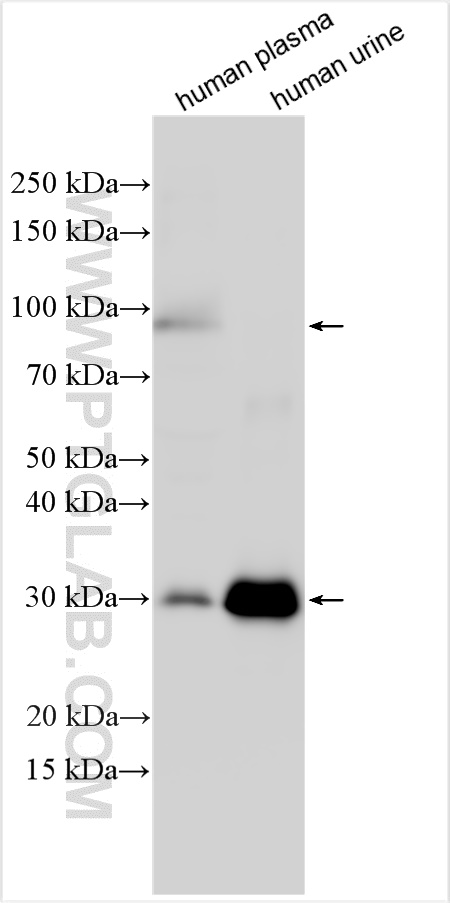 WB analysis using 31801-1-AP