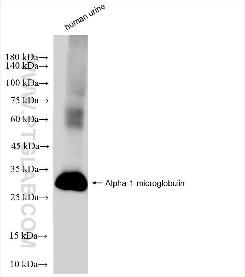 WB analysis of human urine using 83678-3-RR (same clone as 83678-3-PBS)