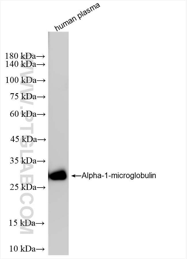 WB analysis of human plasma using 83678-3-RR (same clone as 83678-3-PBS)