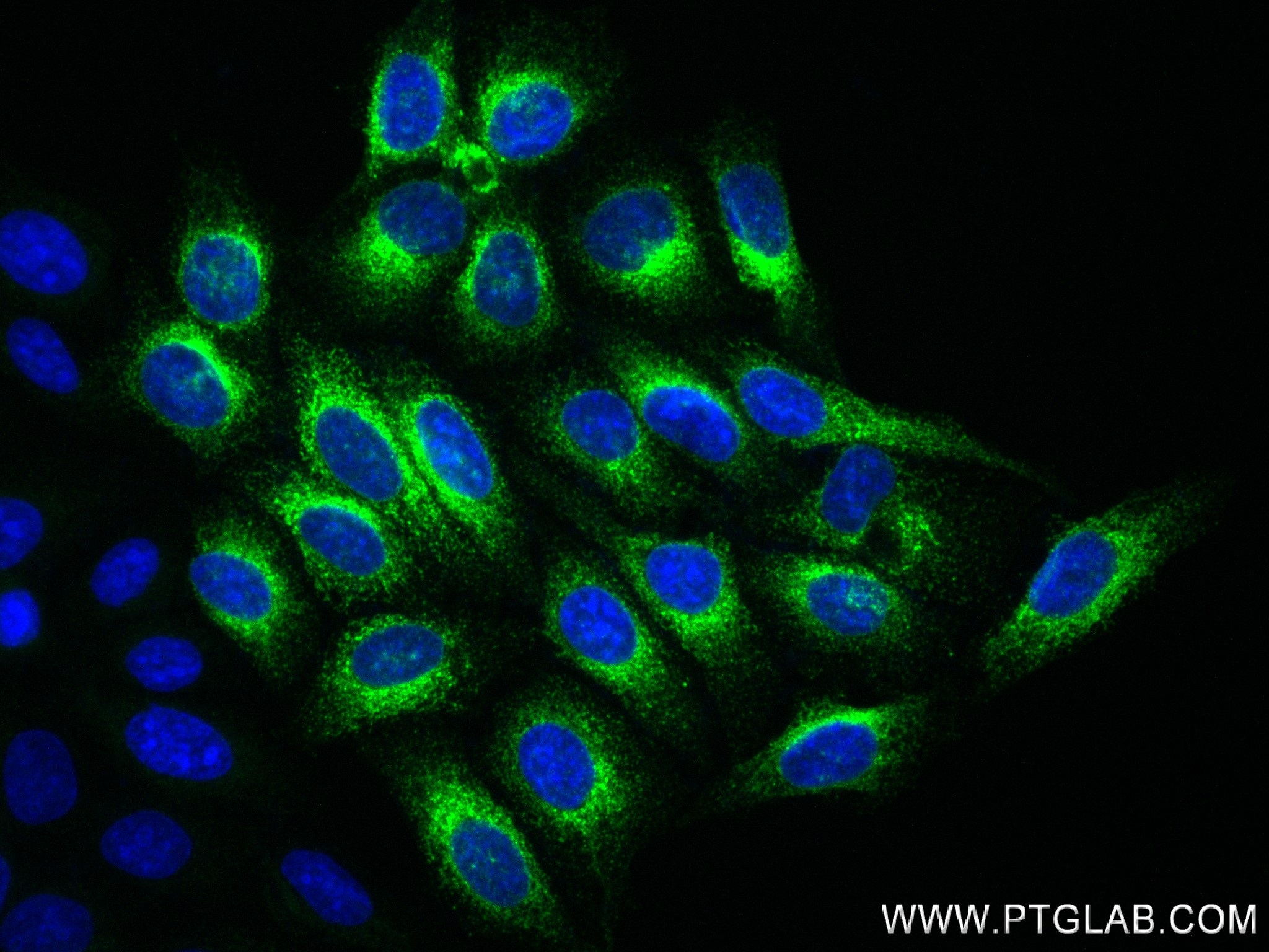 IF Staining of HepG2 using 84347-5-RR (same clone as 84347-5-PBS)